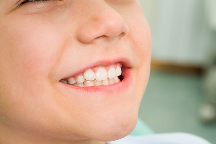 Zęby dziecka – jak o nie dbać?